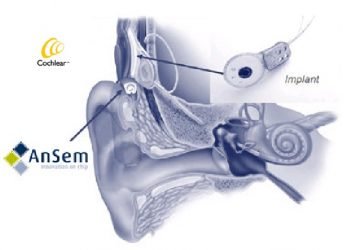 ansem_implant