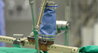 SpineAssist_web_Main