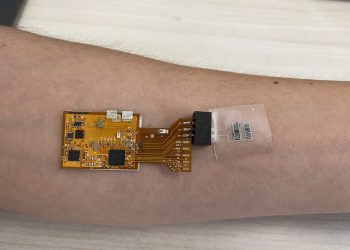 ניטור שחפת באמצעות מדבקה הנצמדת לעור ומודדת את החלקיקים הנדיפים הנפלטים ממנו. קרדיט: דוברות הטכניון