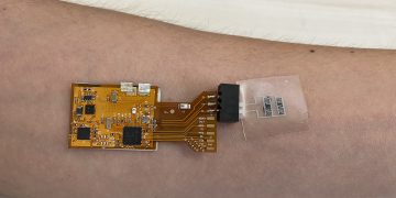 ניטור שחפת באמצעות מדבקה הנצמדת לעור ומודדת את החלקיקים הנדיפים הנפלטים ממנו. קרדיט: דוברות הטכניון