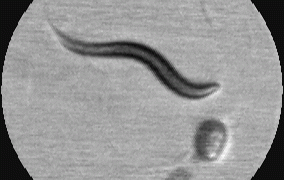 צילום בתנועה של תולעת. באדיבות הטכניון צילום בתנועה של תולעת. באדיבות הטכניון